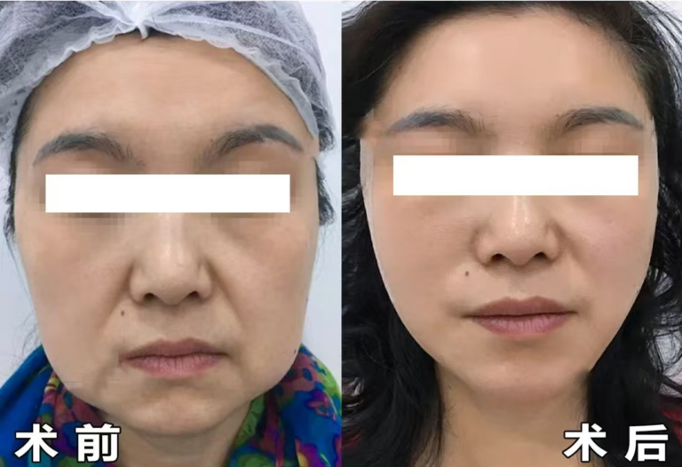 扈医生视频案例合集 | Dr. Hu Video Case Collection