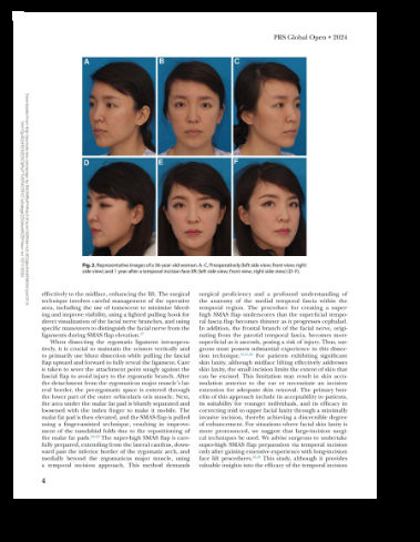 Plastic surgery clinical article