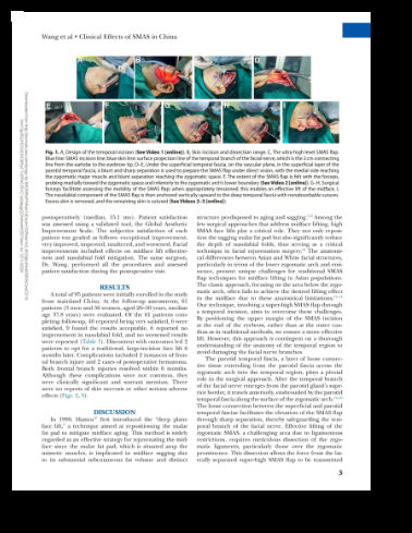 Plastic surgery facial rejuvenation article