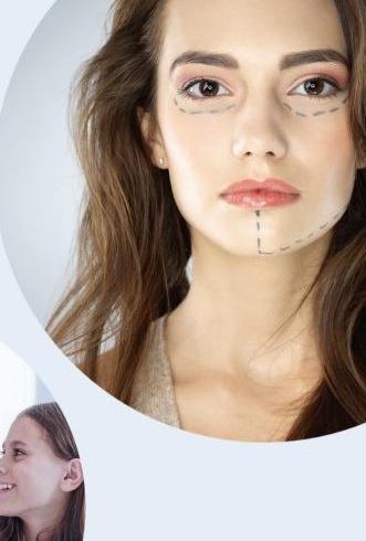 Face recovery check