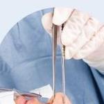 Suture removal detail