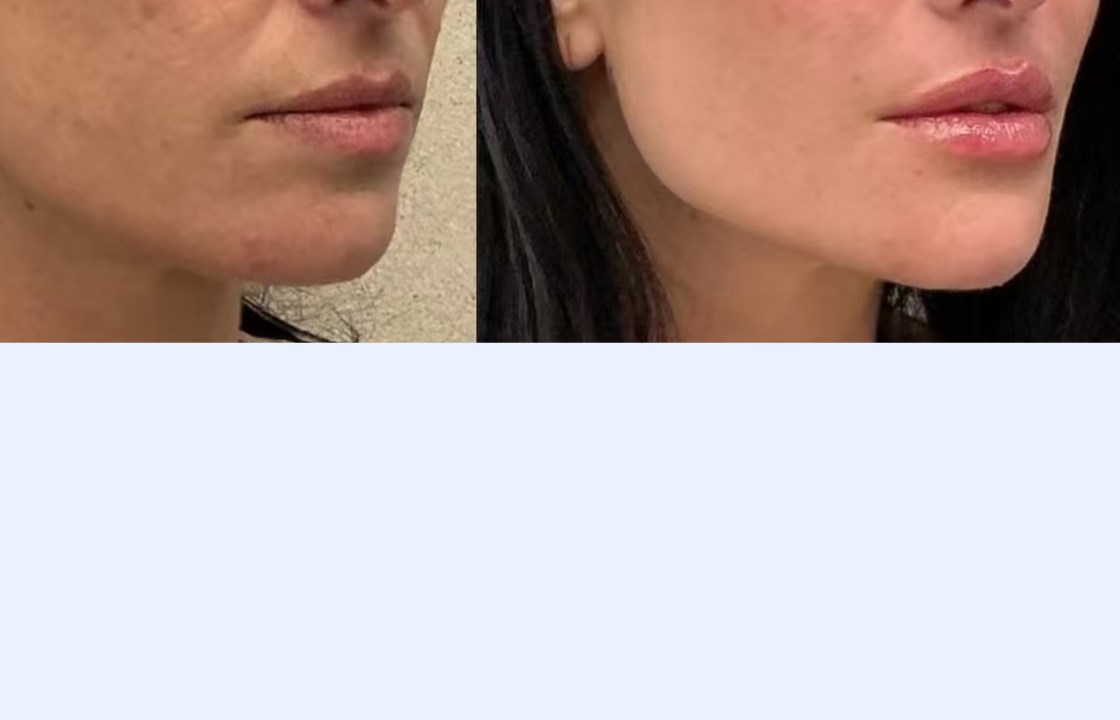 Natural facial contour review result