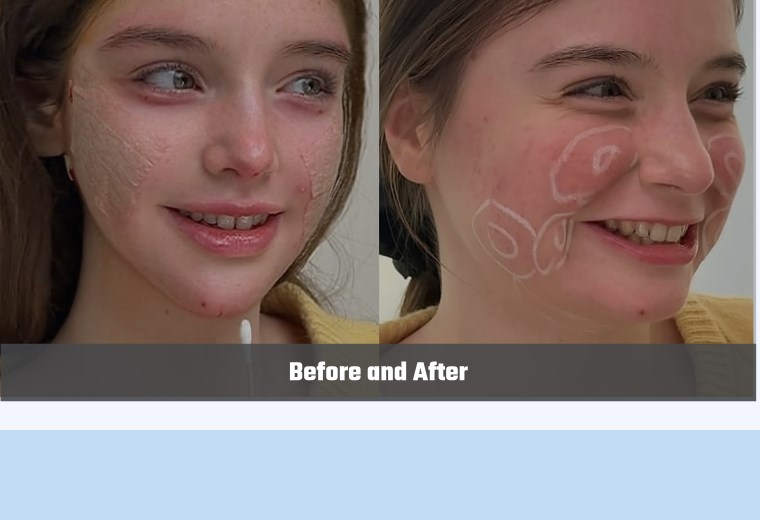 Facial surgery before and after